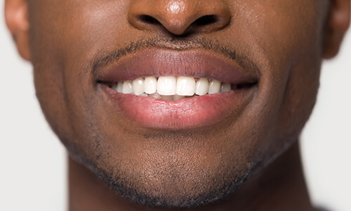 Smiling male with straight white teeth